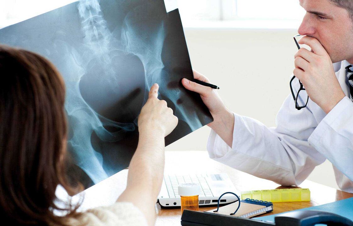 medicii care examinează cu raze X pentru osteoartrita de șold